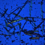 Asbestiform tremolite fibres
